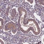 FRMPD1 Antibody in Immunohistochemistry (IHC)