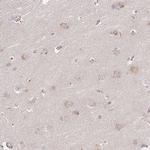 DIMT1 Antibody in Immunohistochemistry (Paraffin) (IHC (P))