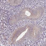 DIMT1 Antibody in Immunohistochemistry (Paraffin) (IHC (P))