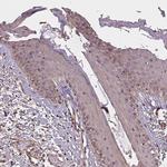 DIMT1 Antibody in Immunohistochemistry (Paraffin) (IHC (P))