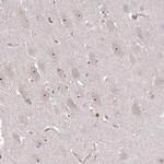 DIMT1 Antibody in Immunohistochemistry (IHC)