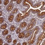 COQ4 Antibody in Immunohistochemistry (Paraffin) (IHC (P))