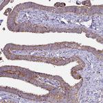 COQ4 Antibody in Immunohistochemistry (Paraffin) (IHC (P))