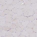 COQ4 Antibody in Immunohistochemistry (Paraffin) (IHC (P))
