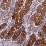 COQ4 Antibody in Immunohistochemistry (Paraffin) (IHC (P))