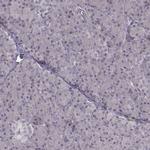 RPGRIP1 Polyclonal Antibody