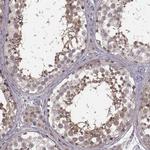 RPGRIP1 Antibody in Immunohistochemistry (IHC)