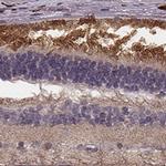 RPGRIP1 Antibody in Immunohistochemistry (IHC)