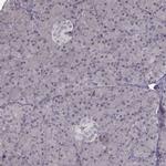 RPGRIP1 Antibody in Immunohistochemistry (IHC)