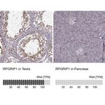 RPGRIP1 Antibody