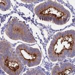 OR2AE1 Polyclonal Antibody
