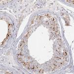 SLC2A11 Polyclonal Antibody