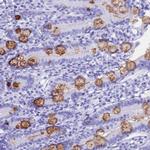 OR10J3 Polyclonal Antibody