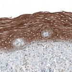 PAPD5 Polyclonal Antibody