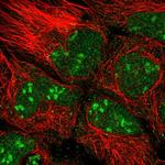 ATPBD4 Polyclonal Antibody