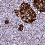 ATPBD4 Antibody in Immunohistochemistry (Paraffin) (IHC (P))
