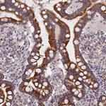 ECSIT Antibody in Immunohistochemistry (Paraffin) (IHC (P))