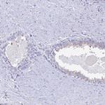 NALP12 Antibody in Immunohistochemistry (Paraffin) (IHC (P))