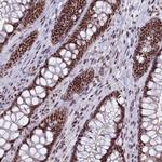 SF3B3 Antibody in Immunohistochemistry (Paraffin) (IHC (P))