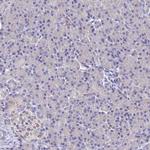 SPNS1 Polyclonal Antibody