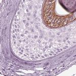 KRTAP3-3 Polyclonal Antibody