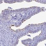 CCDC173 Polyclonal Antibody