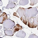 B3GALT4 Polyclonal Antibody