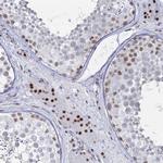 GSC2 Polyclonal Antibody