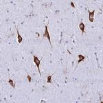 RPL19 Antibody in Immunohistochemistry (Paraffin) (IHC (P))