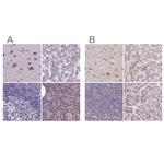CASC4 Antibody in Immunohistochemistry (IHC)