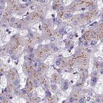 CASC4 Antibody in Immunohistochemistry (IHC)