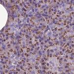 CASC4 Antibody in Immunohistochemistry (IHC)
