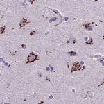 CASC4 Antibody in Immunohistochemistry (IHC)