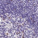 CASC4 Antibody in Immunohistochemistry (IHC)