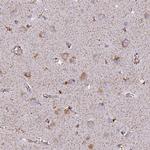 CLCN7 Antibody in Immunohistochemistry (Paraffin) (IHC (P))