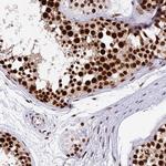 METTL21B Polyclonal Antibody