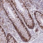 ARMCX6 Antibody in Immunohistochemistry (Paraffin) (IHC (P))