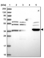 ARMCX6 Antibody in Western Blot (WB)