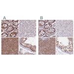 PFDN6 Polyclonal Antibody