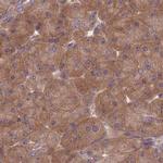 PFDN6 Antibody in Immunohistochemistry (IHC)