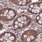 PFDN6 Antibody in Immunohistochemistry (IHC)