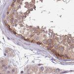 PFDN6 Antibody in Immunohistochemistry (IHC)