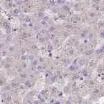 PFDN6 Antibody in Immunohistochemistry (IHC)