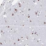 MAGOH Polyclonal Antibody