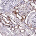 RNaseH1 Polyclonal Antibody