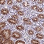 RGS11 Polyclonal Antibody