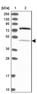 THUMPD2 Antibody in Western Blot (WB)