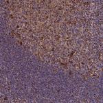 THUMPD2 Polyclonal Antibody