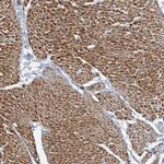 ARGFX Antibody in Immunohistochemistry (Paraffin) (IHC (P))