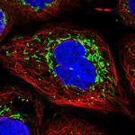 TIMM44 Polyclonal Antibody